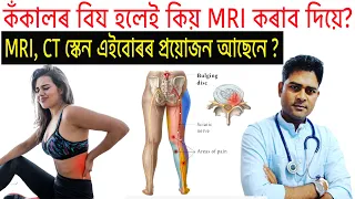 কঁকালৰ বিষ হলে কি কৰিব ? Dr Haris Well future