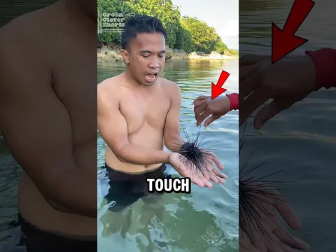 DO NOT Touch This Spiky Thing‼️😱😨