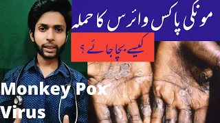 What is Monkey Pox Virus? Treatment, Prevention, Symptoms,How to Spread ,New Virus in Asia/Pakistan