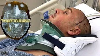 The Accident That Changed My Life Forever