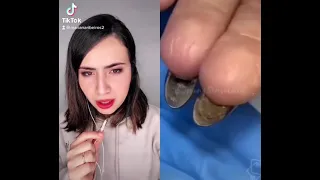 Reagindo a Vídeos - O Perigo das Unhas de Gel