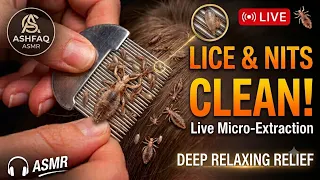 LICE CLEAN LIVE 🔴🪳 219