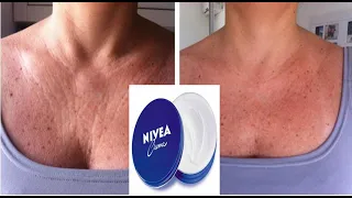 Olha o que eu fiz no meu CREME NÍVEA QUE ACABOU COM TODAS AS RUGAS…