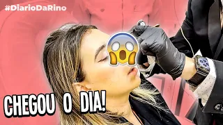 CHEGOU A HORA DE VER O RESULTADO! Diário da Rinoplastia!