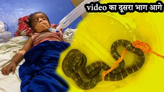 साँप को बनाया बंधक, 17 महीने की बच्ची को काटा सबसे ज़हरीला साँप,फिर बच्ची का क्या हुआ, Krait Bite, CG