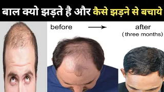 बाल क्यो झड़ते है और कैसे झड़ने से बचाये🤔 ! How to treat Hair fall @Dr.SatyendraYadavMBBS_MD
