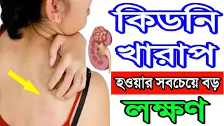 কিডনি নষ্ট হওয়ার আগে দেয় এই ১১টি লক্ষণ || না জানলে মারাত্মক বিপদ হতে পারে || তাই দেরি করবেন না!