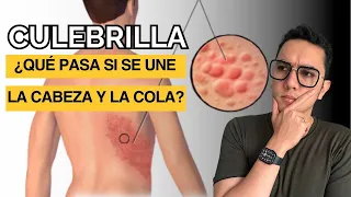 Culebrilla ¿Qué sucede si se une la cabeza con la cola? (Herpes zoster) | Dr. William Guerrero