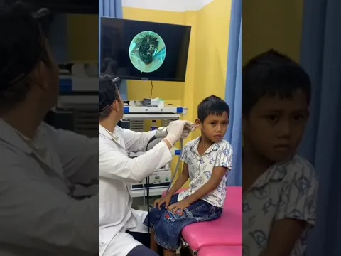 Doctor Removes Giant Earwax Blockage! 😱👂 #ENT #EarCare #Doctor