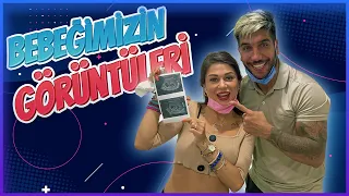 Bebeğimizin İlk Görüntüleri (Kalp Atışını Dinledik)