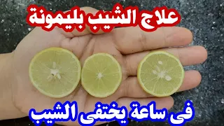 ليمونة واحدة تخلصك من الشيب حتي لو الشعر كله ابيض /علاج الشيب والشيب المبكر