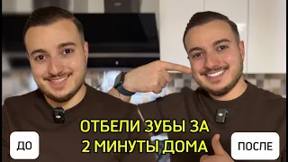 ОТБЕЛИ ЗУБЫ ДОМА ЗА 2 МИНУТЫ! ДЕШЕВО И ЭФФЕКТИВНО!