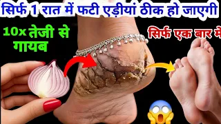 गारंटी है! 1 ही रात में ठीक हो जाएंगी फटी एड़ियांये जादुई उपाय एड़ी सॉफ्ट-मुलायम करेगा 😱 Cracked Heels