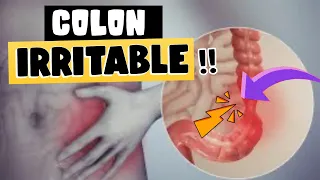 ¿TIENES ESTOS SÍNTOMAS?  - CUIDADO !! COLON IRRITABLE