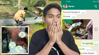 TANGAN ANAK INI RUSAK AKIBAT MAIN PETASAN PELASTIK GAS!!!