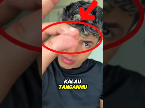 "Jangan Tarik! Cara Rahasia Lepas Lem dari Tangan Tanpa Sakit"