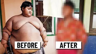 Amazing Transformation of The World's Fattest Boy