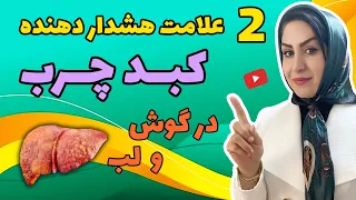 رازهای تشخیص کبد چرب بدون سونوگرافی | بهترین روش طبیعی درمان کبد چرب