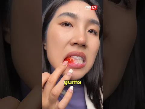Beware! Bleeding Gums Can Be a Sign of Serious Disease‼️😱