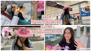ME QUITARON LOS BRACKETS/ 24 HORAS CON EL SOMBRERO DEL FILTRO!