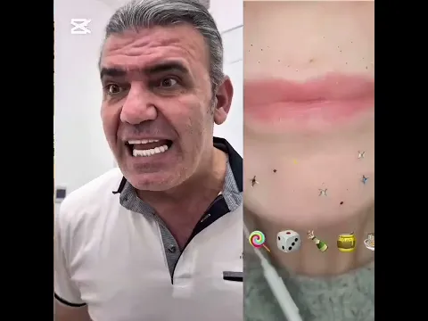 🥲💔كرومة عراقية تصميم شاشة سوداء شعر عراقي بدون حقوق