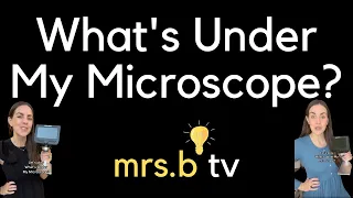 What's Under My Microscope? 🔬👀🤯