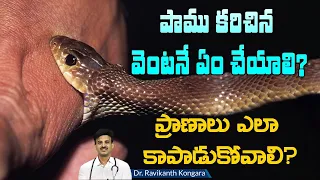 Know about Snake Bite | First Aid for Snake Bite | Types of Snake Bite | Dr.Ravikanth Kongara