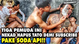 NEKAD!!! HAPUS TATO PAKE SODA AP! AKHIRNYA LUK4 SEMUR H1DUP‼️