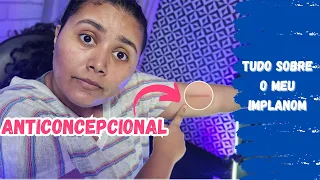 Eu não menstruo mais! CHOREI! | Relato 12 #autismo #implanon #lifestyle