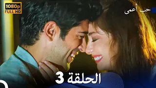 حب أعمى الحلقة 3 (Arabic Dubbed)