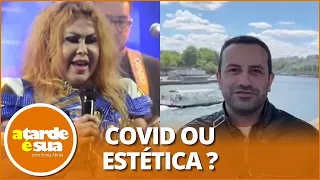 Cirurgião Plástico aponta “reação a procedimentos estéticos” no rosto de Joelma