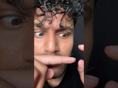 Sick handnail😱😭 #bikueating #funny #eatingchallenge #asmr #food #pain