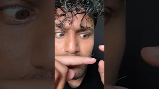 Sick handnail😱😭 #bikueating #funny #eatingchallenge #asmr #food #pain