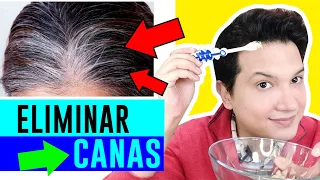 COMO ELIMINAR las CANAS prematuras en jóvenes rápido | Remedios Naturales | Andy Zaturno