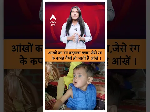 UP News: आंखों का रंग बदलता बच्चा,जैसे रंग के कपड़े वैसी हो जाती है आंखें ! | ABP GANGA