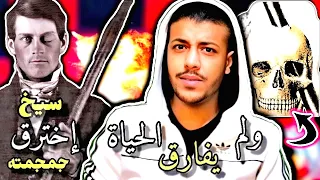 اخترق جمجمته سيخ حديد طوله 1 متر و بقي على قيد الحياة لمدة .....! ) مع امير