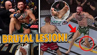 CONOR MCGREGOR SUFRE BRUT4L LESIÓN CONTRA DUSTIN POIRIER EN UFC 264 | CONOR MCGREGOR SE ROMP3 EL PIE