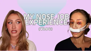 The Reality of a Nose Job: My Septorhinoplasty Experience
