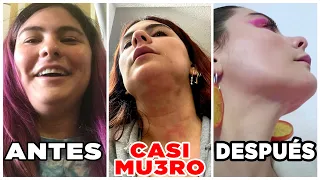 ADIÓS 👋 / ¡casi me mu3r0 por esto! ¿Qué me hice en la cara? -Ixpanea