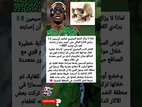 أوسيمين لا يتخلى عن قناعه بعد عامين من إصابة مروعة