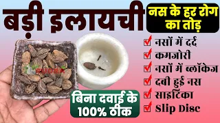 नसों में दर्द + कमजोरी | दबी हुई नस,साइटिका Slip Disc Pain होगा 100% ठीक Naso ka dard ka Ilaj