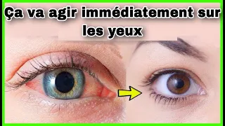 utilise cette astuce, ça va nettoyer les yeux et redonner la couleurs blanche aux yeux!