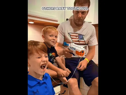 OTHERS BABY TOOTH PULL VS THIS BOY #shorts