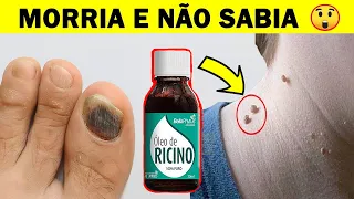 O Que Quase Ninguém Sabe Sobre o ÓLEO DE RÍCINO! Porque Não Fiz Isso Antes 😱