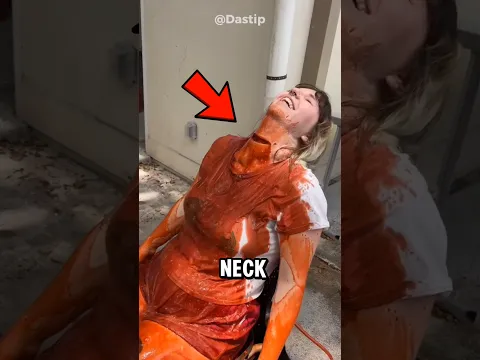 Oh my god! His neck was cut but..😰