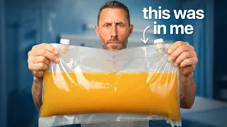 I Removed 48 Years Of Toxins From My Blood