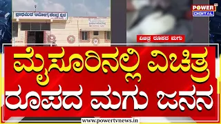 Strange Child : ಮೈಸೂರಿನಲ್ಲಿ ವಿಚಿತ್ರ ರೂಪದ ಮಗು ಜನನ | Mysuru | Power TV News