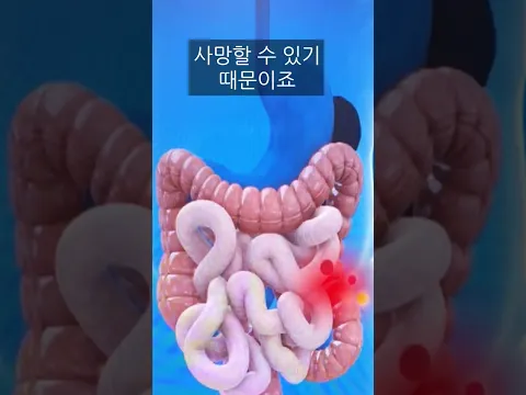 칼에 찔렸을때 살아남는 방법 (칼뽑기vs그대로두기)