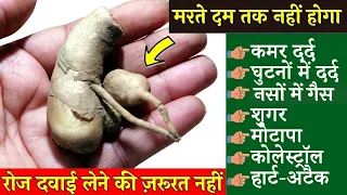 मरते दम तक - नही होगी डायबिटीज मोटापा नसो की ब्लॉकेज हार्ट अटैक बुरा कोलेस्ट्रोल/Naso me blockage