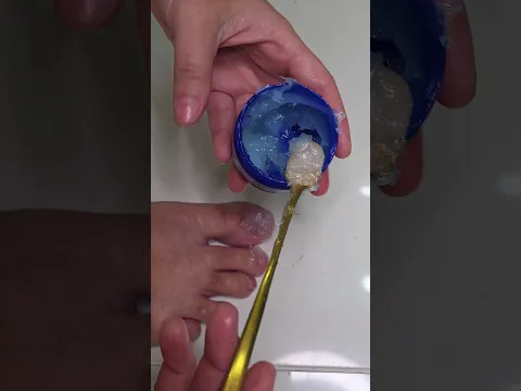Mentol en las uñas